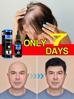 Унисекс масло за растеж на косата Лечение на косопад Бърз растеж на косата Ефективно възстановяване на плешивостта Наследствен следродилен косопад